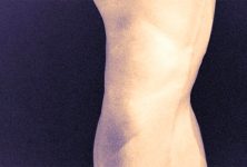 Crepitación ligada a incidencia de osteoartritis sintomática de rodilla