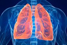 Se identifica una asociación protectora del asma contra la sepsis