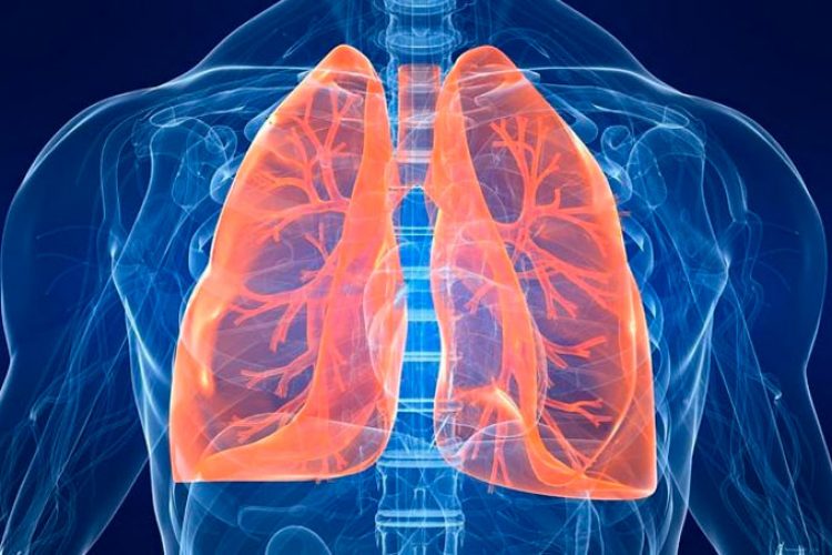 Se identifica una asociación protectora del asma contra la sepsis