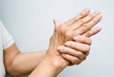 Diferencias raciales y étnicas en  el tratamiento de la artritis reumatoide