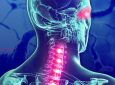 Los buenos resultados de Ocrelizumab en la esclerosis múltiple