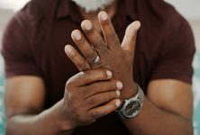 Disparidades raciales en las comorbilidades de los pacientes con artritis psoriásica