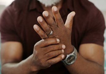 Disparidades raciales en las comorbilidades de los pacientes con artritis psoriásica